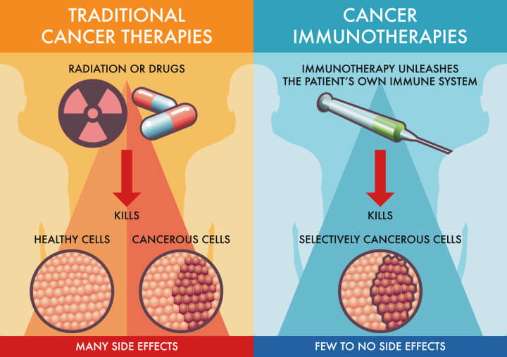 immunoterapia